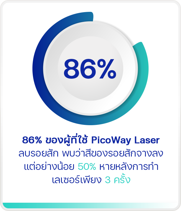 PicoWay Laser ลบรอยสักที่คุณไม่ต้องการ สีออกหมดจด ดูสะอาดตา