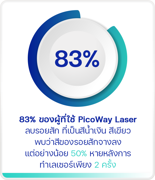 PicoWay Laser ลบรอยสักที่คุณไม่ต้องการ สีออกหมดจด ดูสะอาดตา