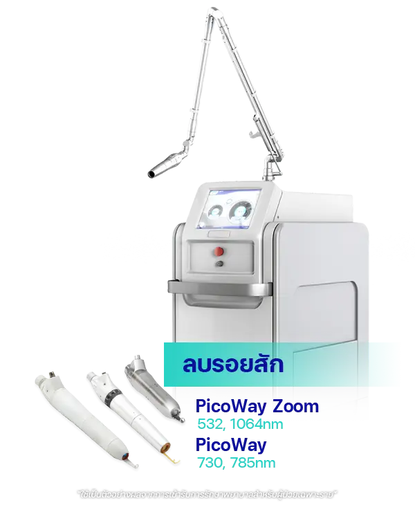 เลเซอร์รอยสัก Picoway zoom