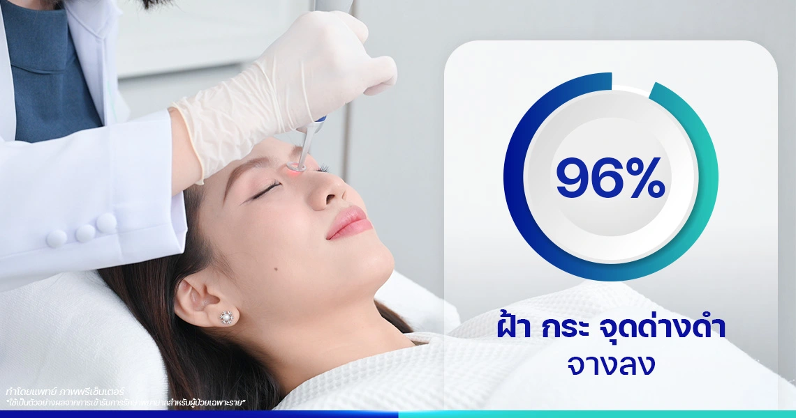 งานวิจัย ลดเม็ดสีจุดด่างดำ