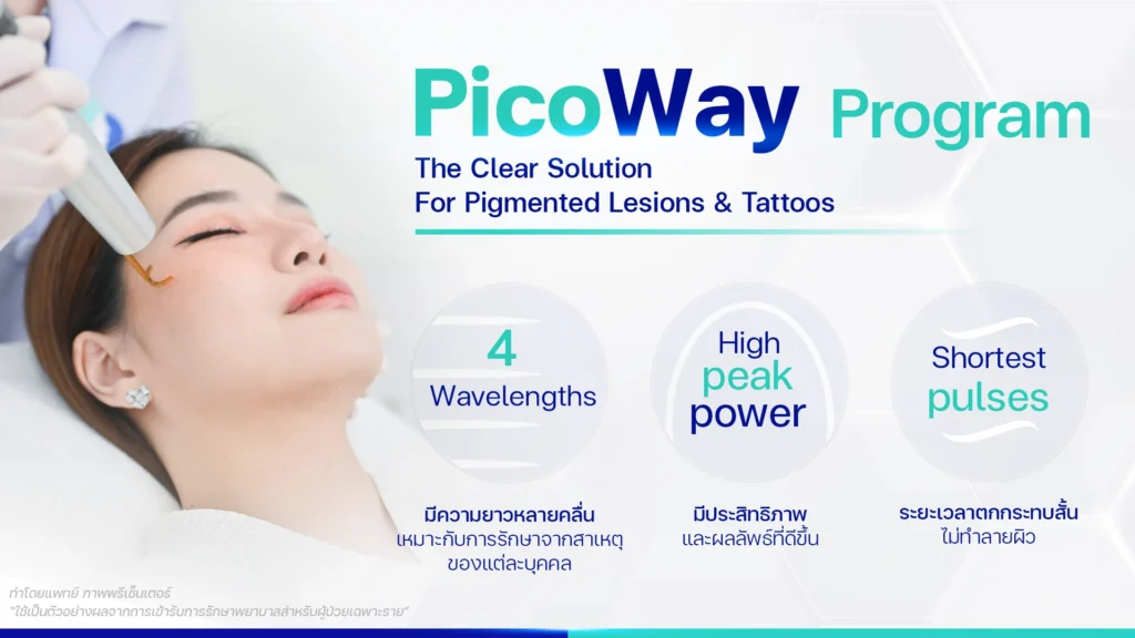 Picoway ข้อดี